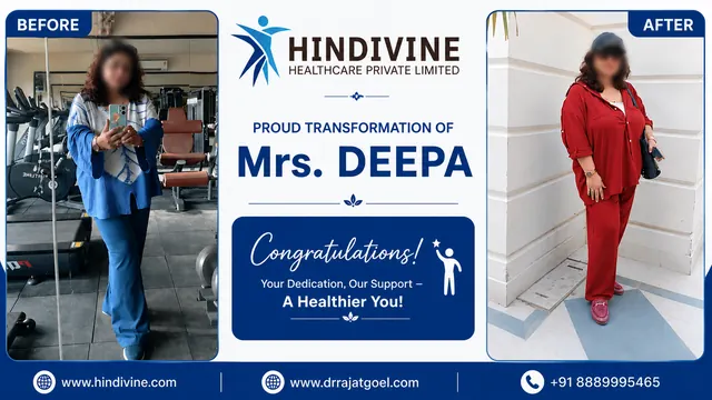 Patient result, face blurred for privacy: Mrs. Deepa, Sustained transformation