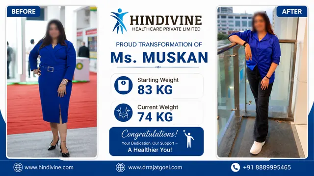 Patient result, face blurred for privacy: Ms. Muskan, 83 kg → 74 kg