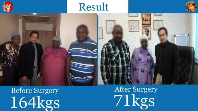 Patient result, face blurred for privacy: 164 kg → 71 kg, After bariatric surgery